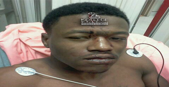DCYoungFly Talks Being Stabbed