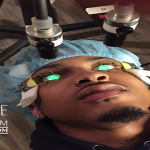 August Alsina Undergoes Eye Surgery To Correct Blindness
