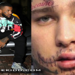 The Game Says Stitches Is Lying About Being Sucker Punched