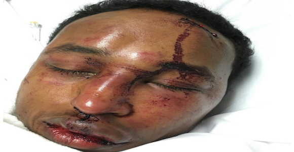 Toronto Rapper Mo-G Brutally Beaten After Drake Ghostwriting Allegations
