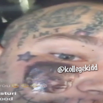 Stitches Gets Son’s Face Tatted On Cheek