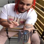 Rapper Gets $250K Procedure To Get Autotune Implanted In Arm