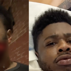 Alabama Rapper Leak Sosa Survives Knife Attack, Spits Freestyle After Surgery
